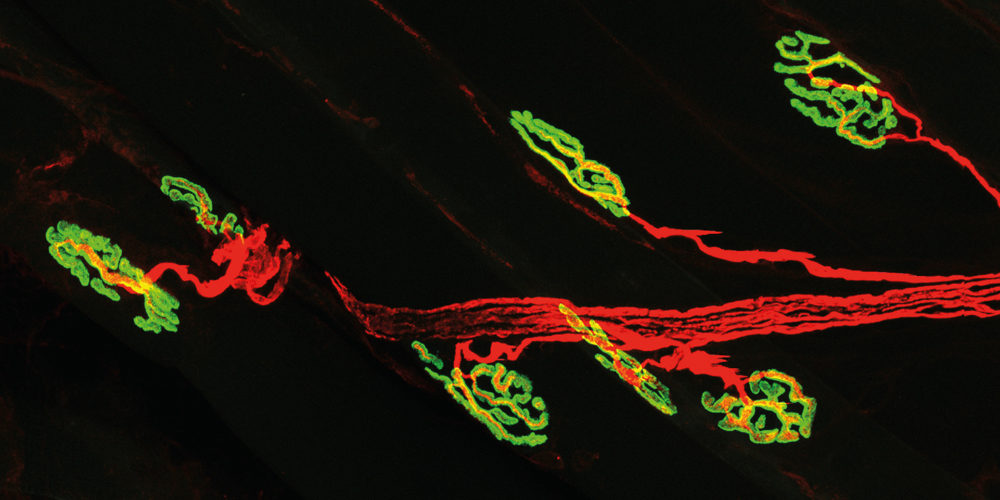 Click to enlarge neuromuscular
