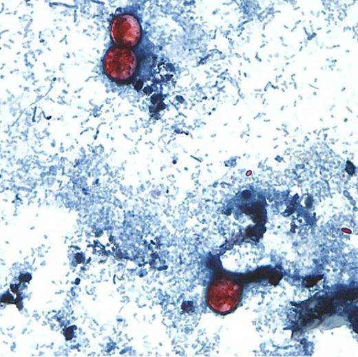 Cyclospora