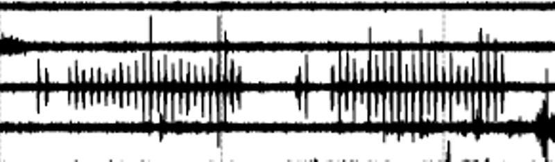 Oklahoma acoustic anomaly -  pattern, twice. Two pulses followed by a gap, followed by 24 pulses.