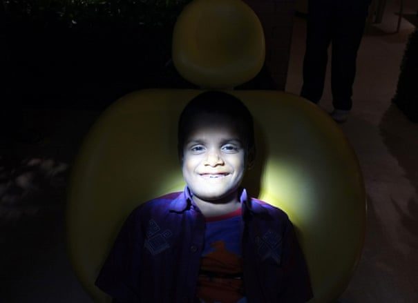 Indian boy with 526 teeth