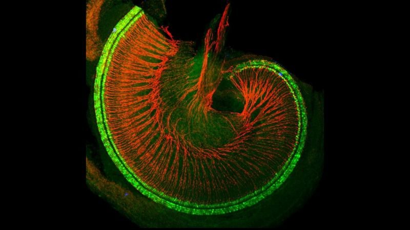 Click to enlarge Mouse cochlea with hair cells