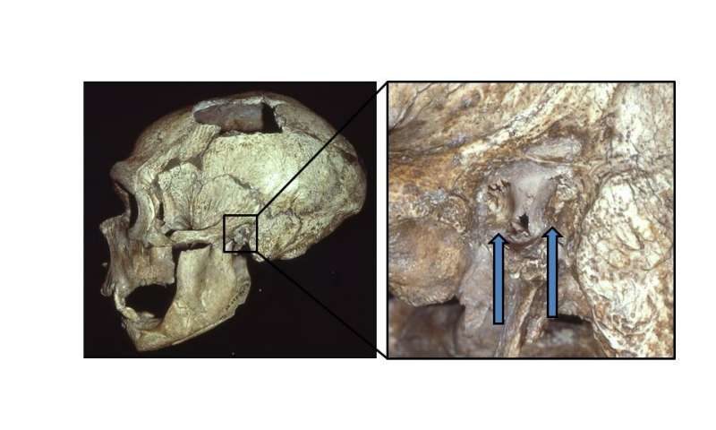 Click to enlarge The La Chapelle-aux-Saints Neandertal