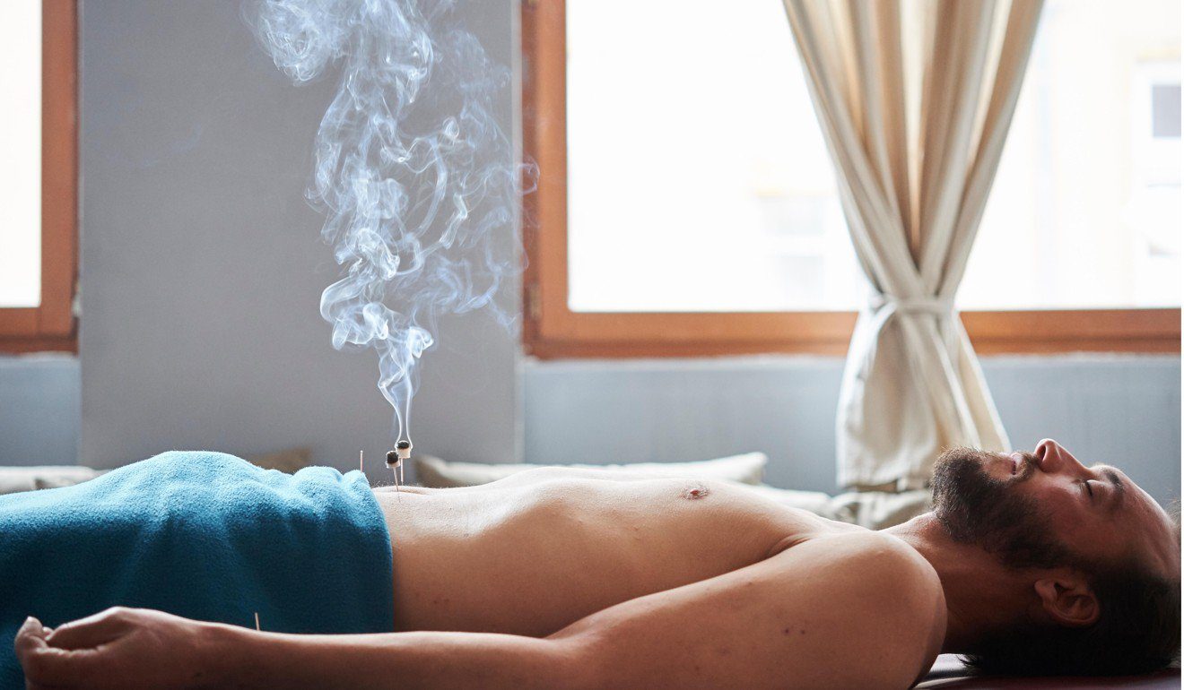 acupuncture