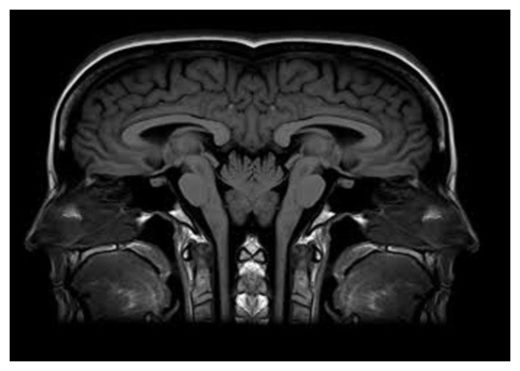 Left Right Brain