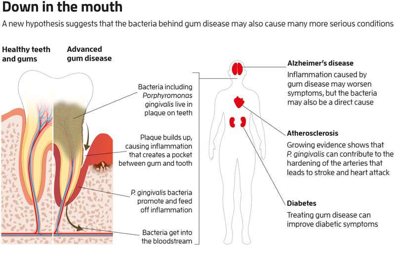 mouth bacteria