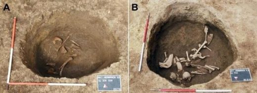 cranial deformation