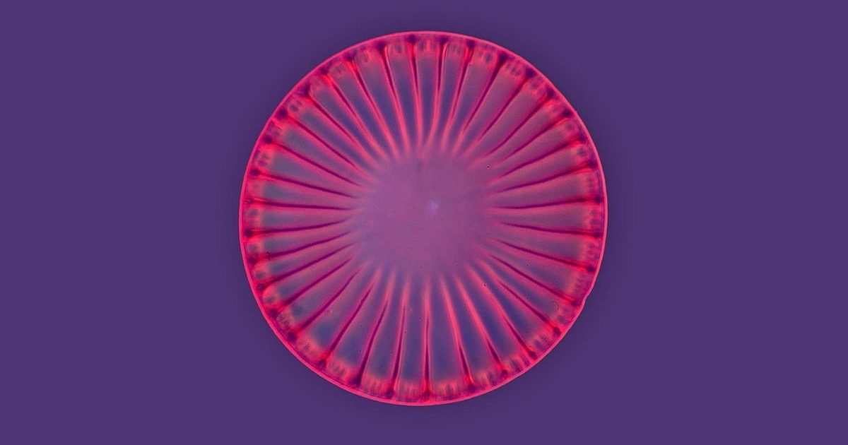 Click to enlarge diatom