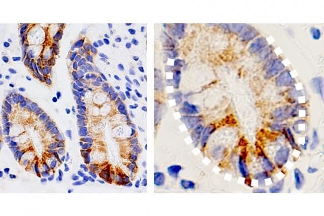 intestinal stem cells