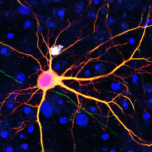 Neuron targeted using SATI technology.