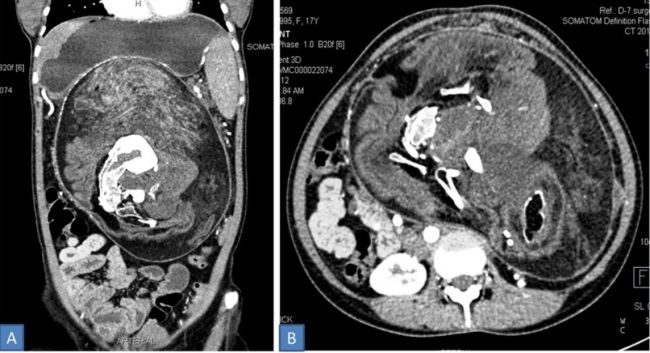 Click to enlarge stomach scan