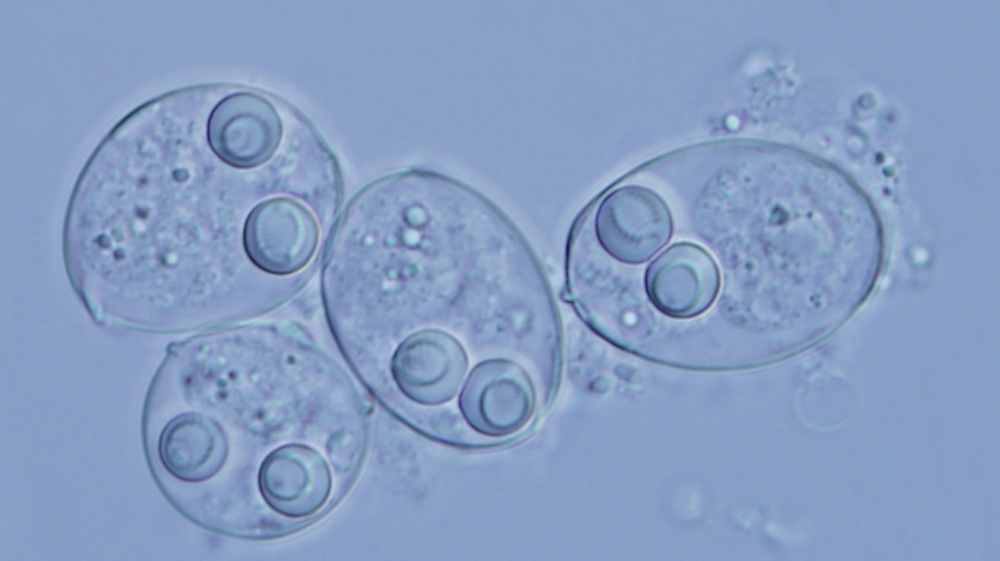parasites myxosporeans