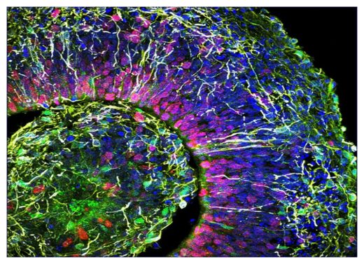 A cross-section of a brain organoid