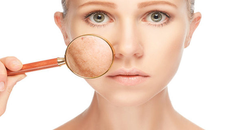 bad skin care, moisturizers