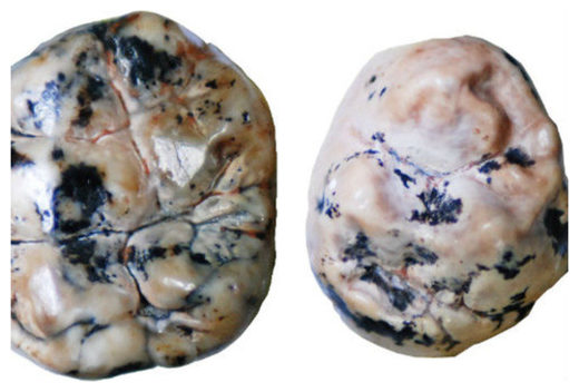Click to enlarge Fossilised Teeth