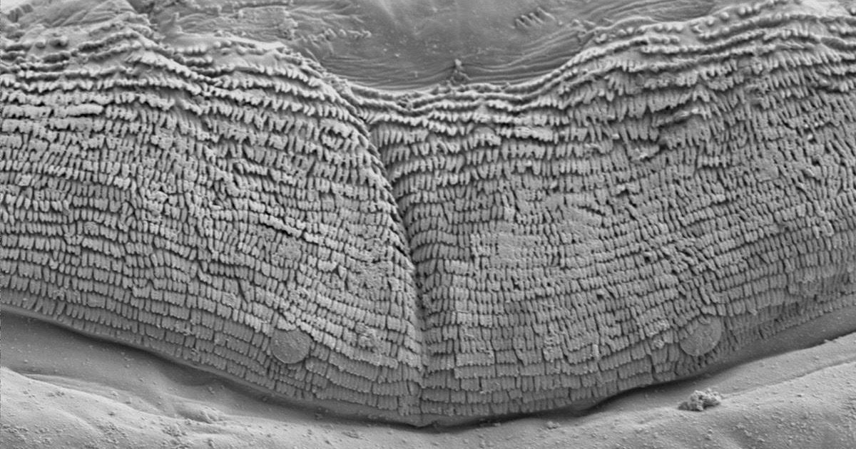 electron microscope fly larvae