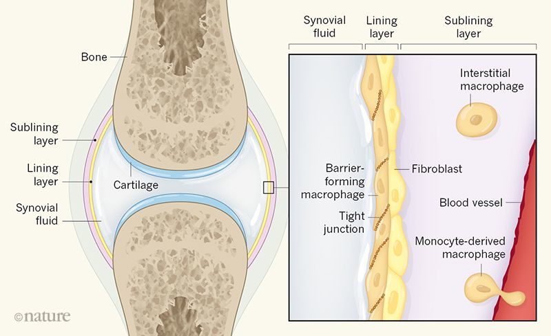 Click to enlarge mapcrophages cartilage joints