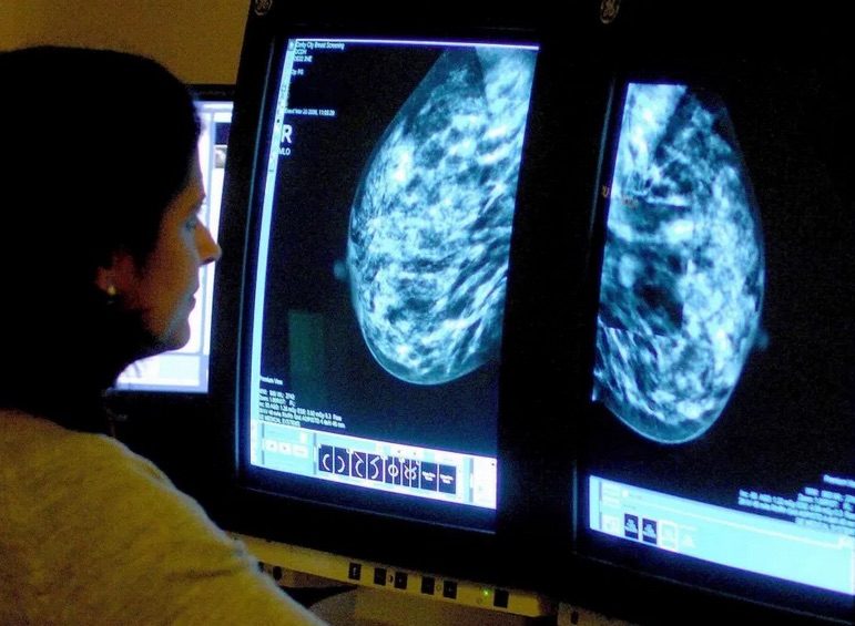 Click to enlarge breats x-ray
