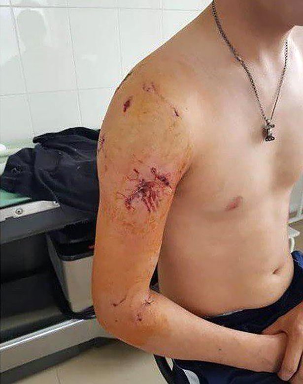 Incredibly student Nikolay survived the bear attack