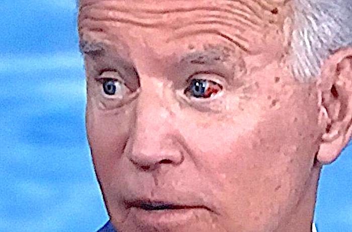 Click to enlarge Biden blood eye