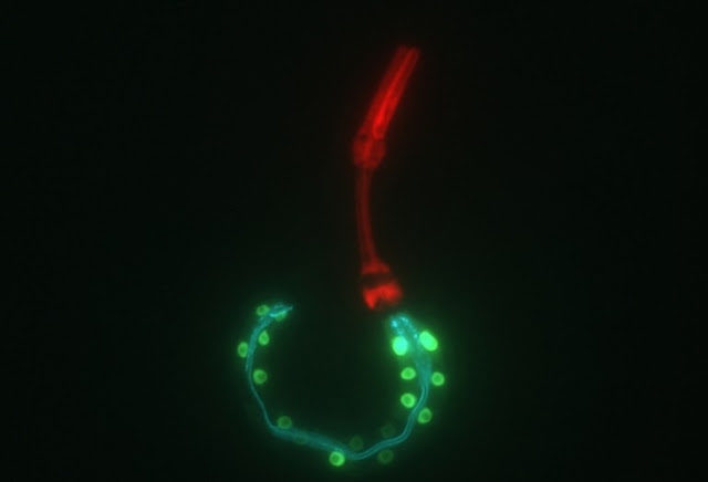 Click to enlarge elegans worm