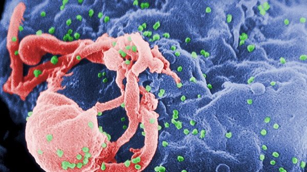 Virus