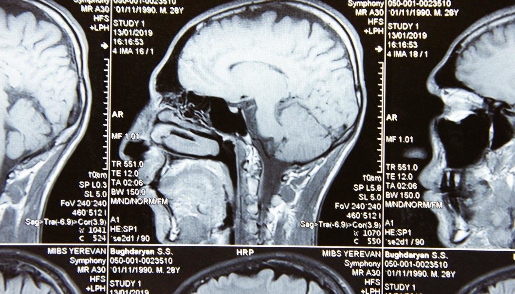 Click to enlarge Brain Studies
