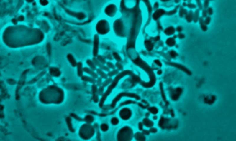 Click to enlarge E.coli