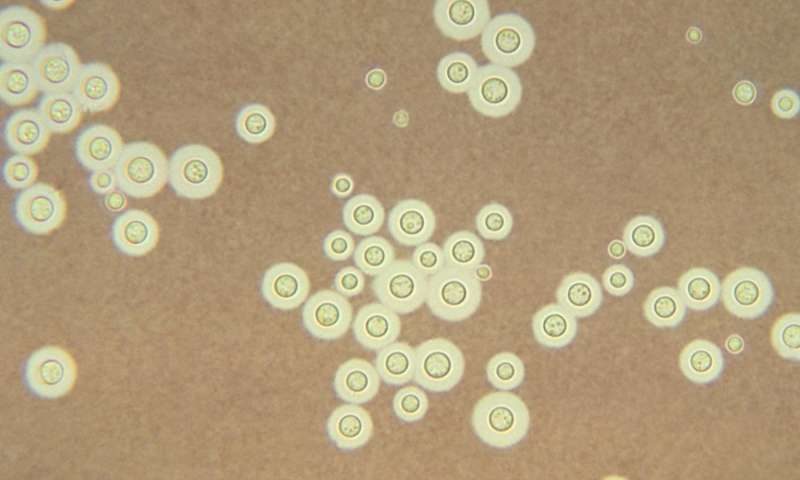Click to enlarge Cryptococcus