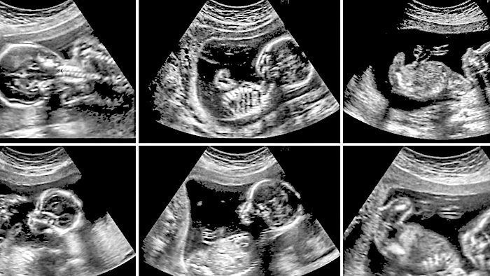 Womb shots