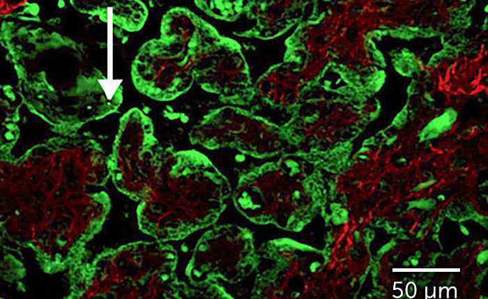 Carbon particles placenta