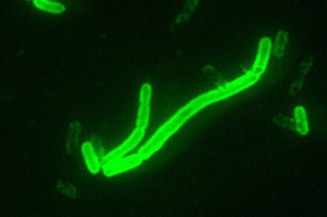 Click to enlarge Yersinia pestis