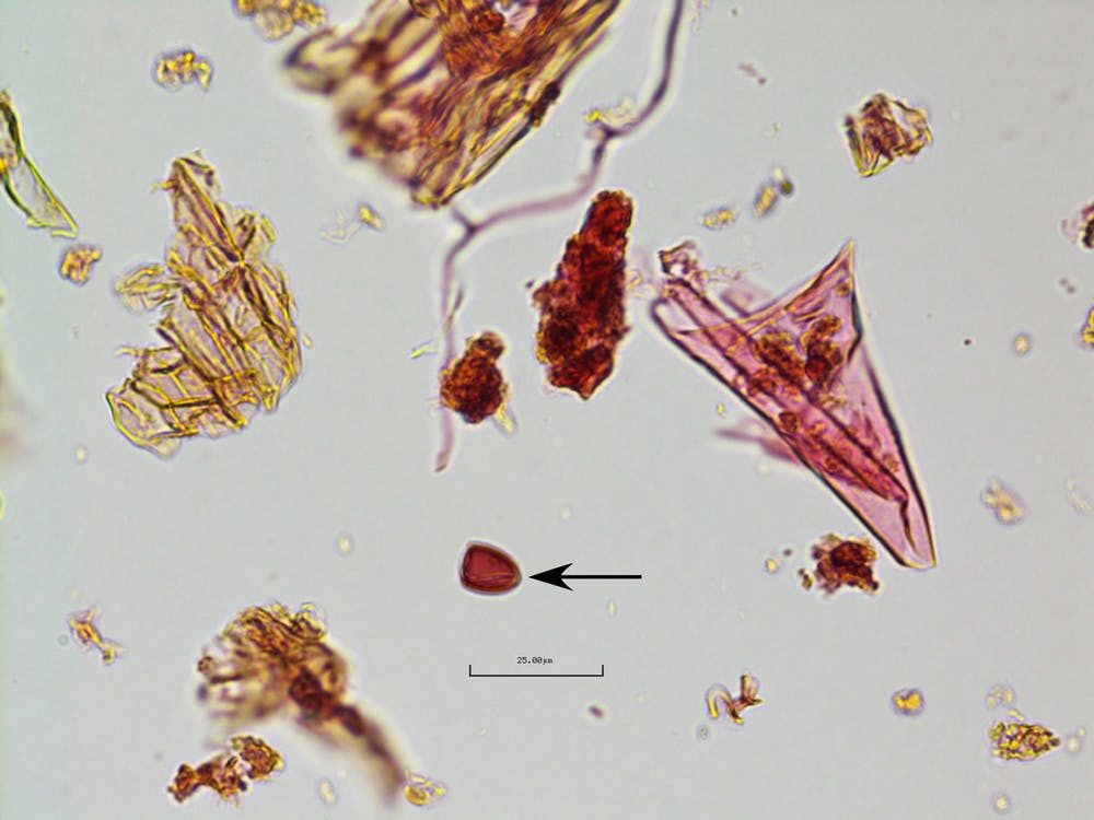 Click to enlarge Fungal Spores