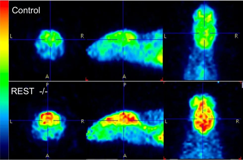 Click to enlarge mouse brain MRI