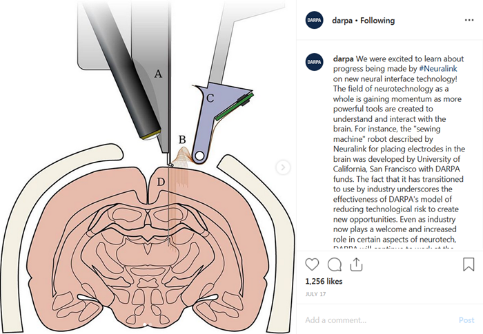 Click to enlarge Darpa Neuralink