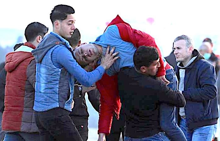 Wounded Palestinian