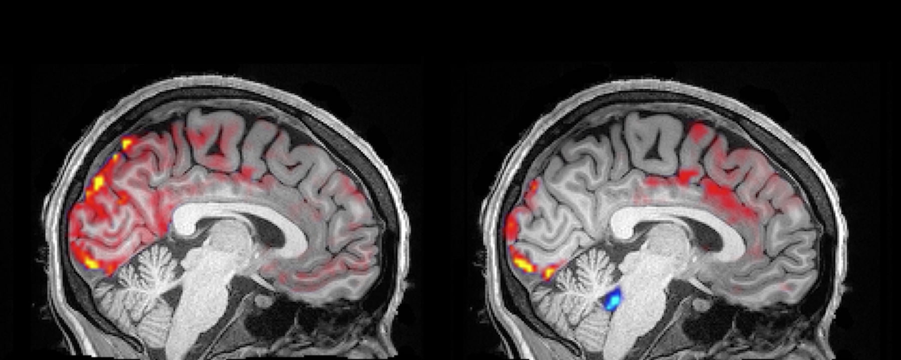 Click to enlarge cerebrospinal