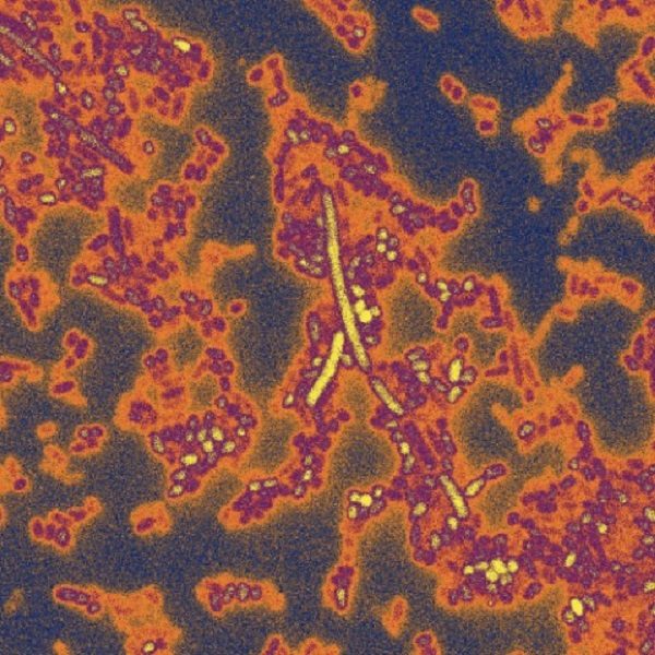 gut bacteria