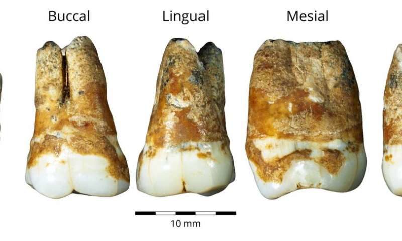 Click to enlarge molars