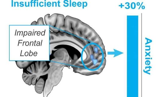 Click to enlarge sleepless