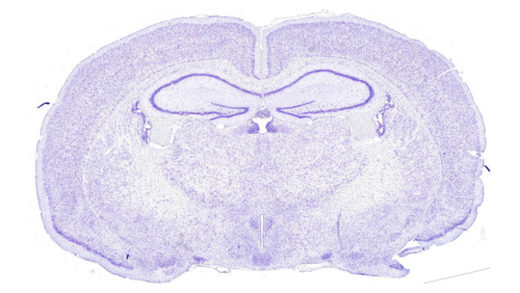 Cross-section of rat brain