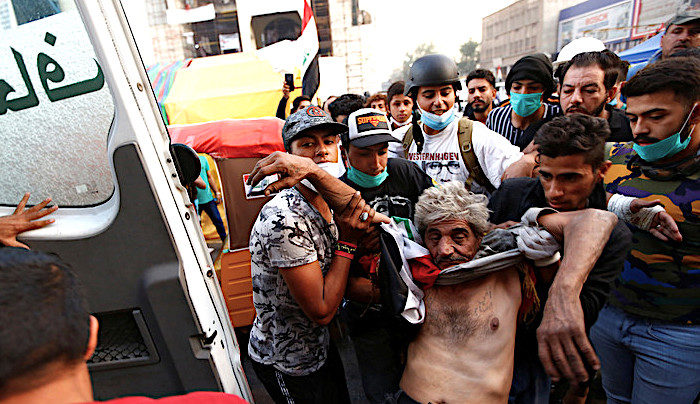 man injured protest