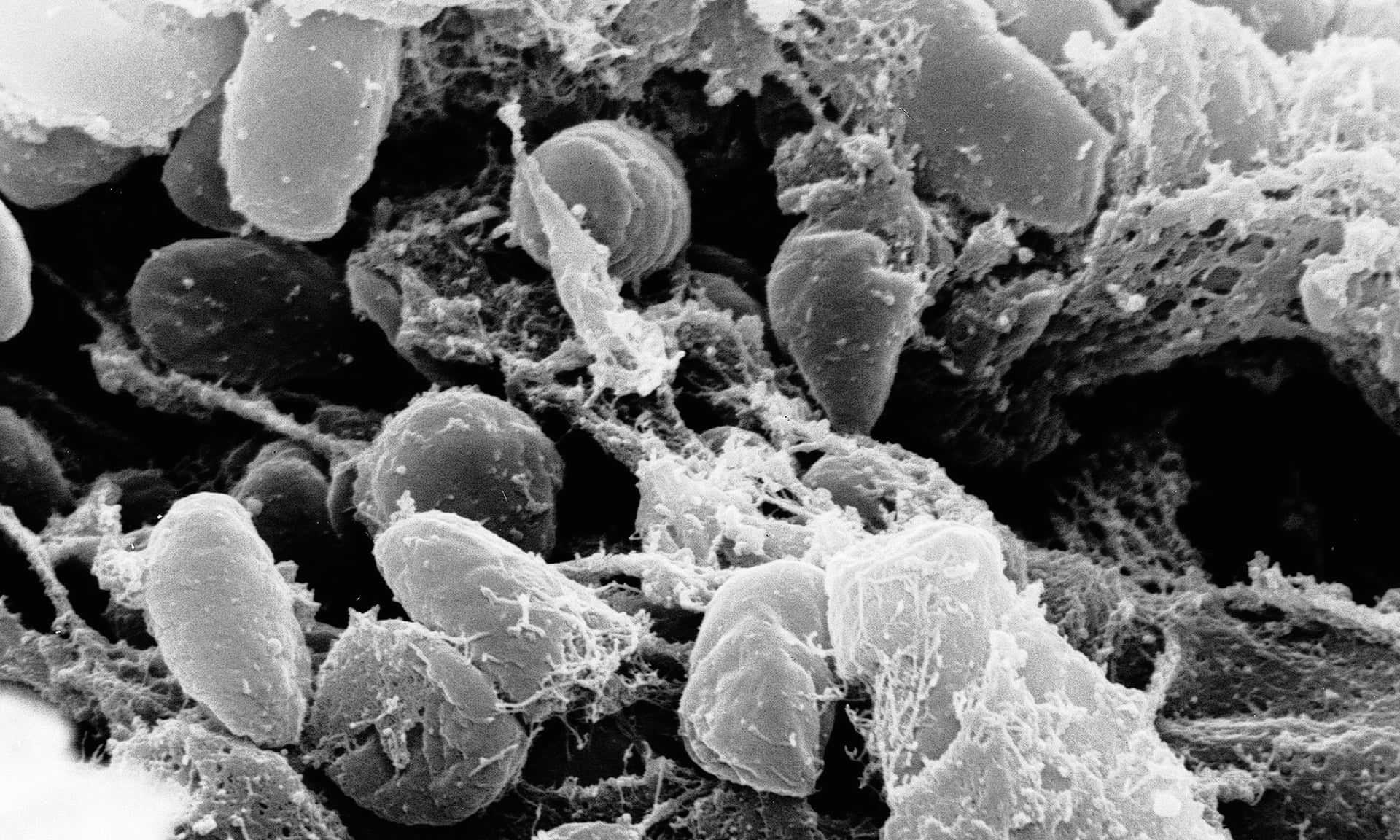 pneumonic plague