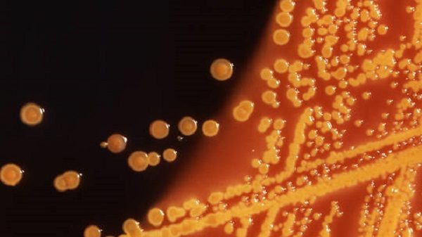Colonies of E. coli bacteria