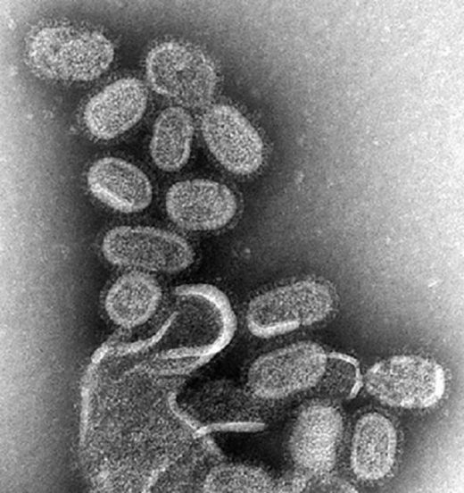 influenza virus microscopy