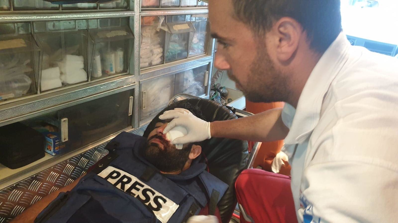 Click to enlarge palestinina journalist lose eye