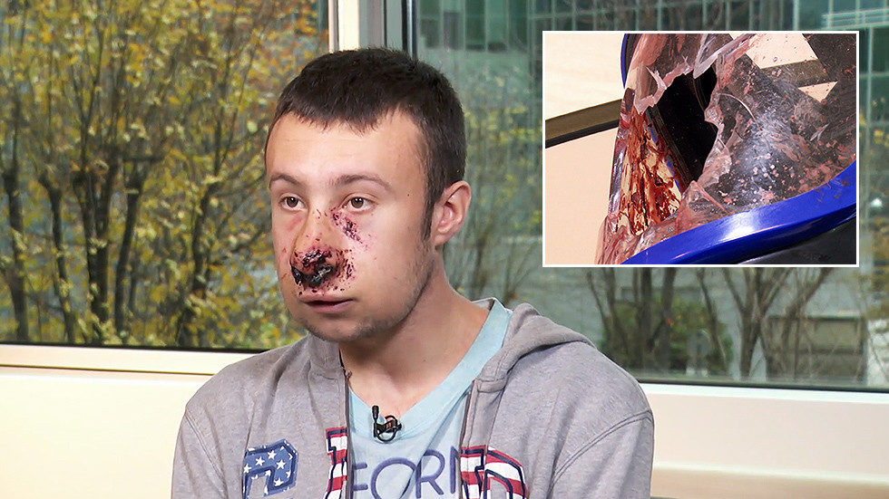 journalist exploding tear gas broken nose yellow vest
