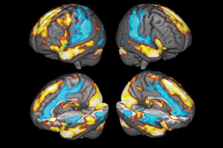 neural correlates of gratitude