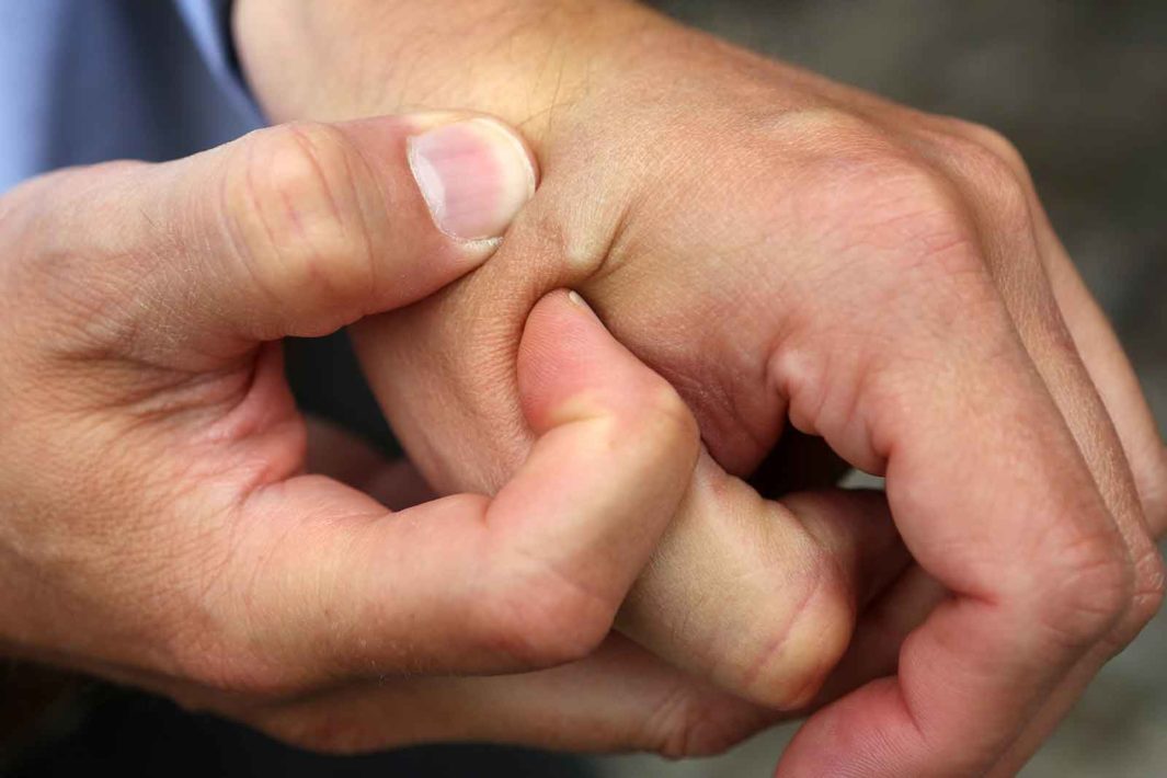 Click to enlarge Microchip Implant