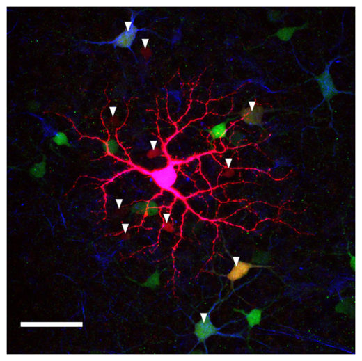 Click to enlarge Retinal Cells