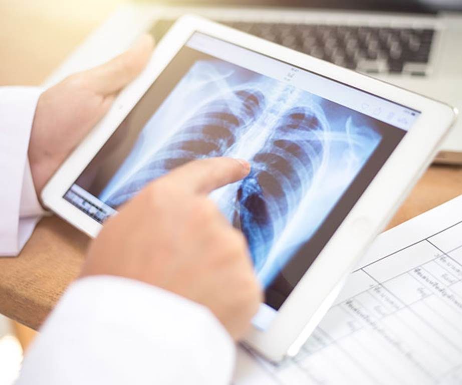 xray surprise